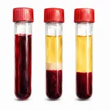 Vials of blood, plasma and serum
